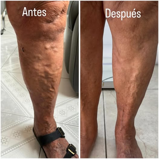 Velvora Compresión negro 20 - 30 mmHg